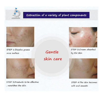 Bioaqua Anti Acne Cleanser