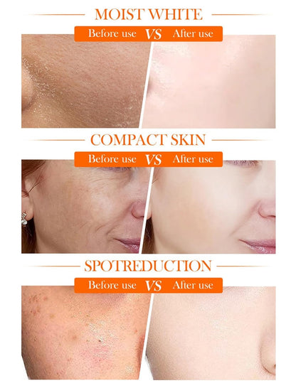 Sadoer 5x Vitamin C Skin Active Whitening Cream