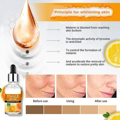 Vitamin-c Serum With Anti-aging & Skin Brightening